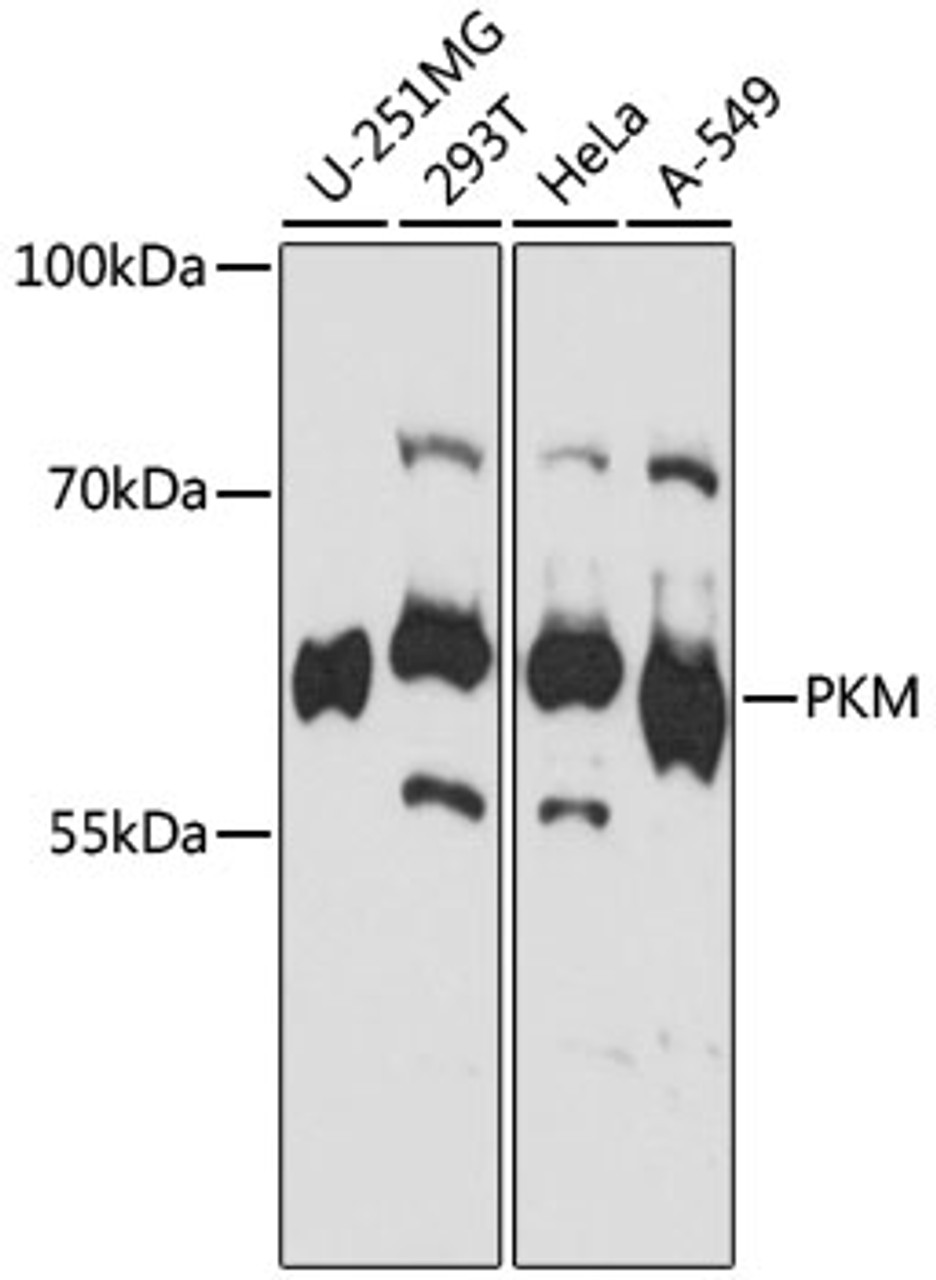 Western blot analysis of extracts of various cell lines, using PKM antibody (16-721) at 1:1000 dilution.<br/>Secondary antibody: HRP Goat Anti-Rabbit IgG (H+L) at 1:10000 dilution.<br/>Lysates/proteins: 25ug per lane.<br/>Blocking buffer: 3% nonfat dry milk in TBST.<br/>Detection: ECL Basic Kit.<br/>Exposure time: 10s.