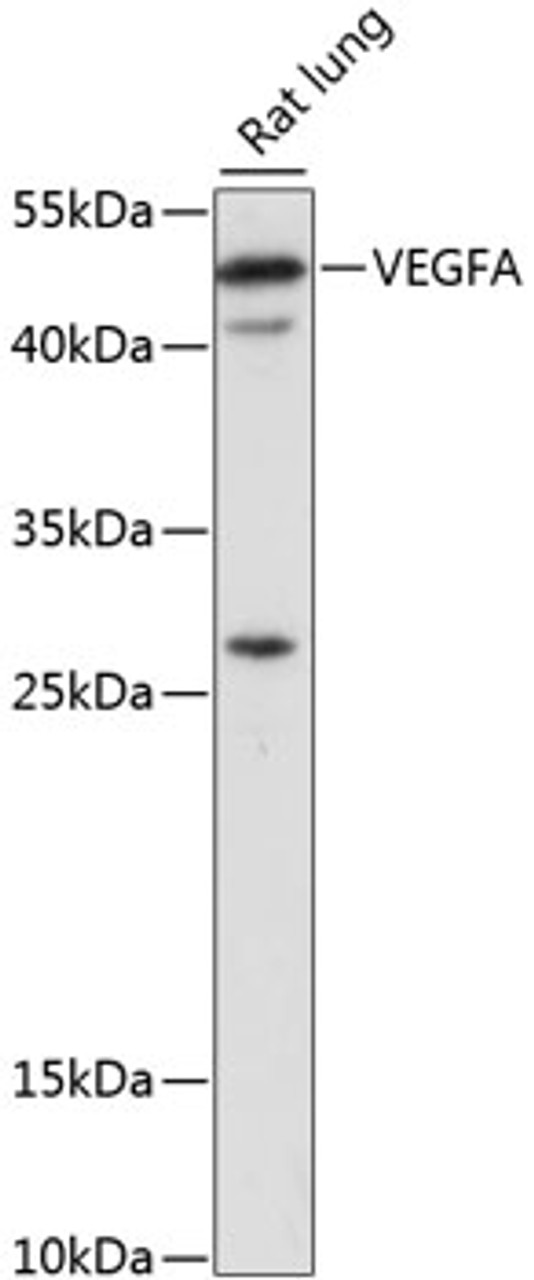 Western blot analysis of extracts of rat lung, using VEGFA antibody (16-722) at 1:1000 dilution.<br/>Secondary antibody: HRP Goat Anti-Rabbit IgG (H+L) at 1:10000 dilution.<br/>Lysates/proteins: 25ug per lane.<br/>Blocking buffer: 3% nonfat dry milk in TBST.<br/>Detection: ECL Basic Kit.<br/>Exposure time: 30s.