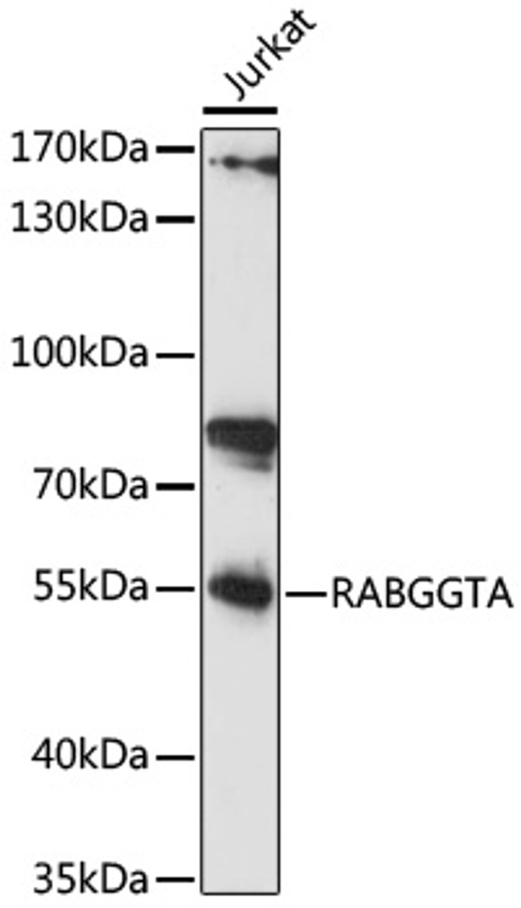 Western blot analysis of extracts of Jurkat cells, using RABGGTA antibody (16-731) at 1:1000 dilution.<br/>Secondary antibody: HRP Goat Anti-Rabbit IgG (H+L) at 1:10000 dilution.<br/>Lysates/proteins: 25ug per lane.<br/>Blocking buffer: 3% nonfat dry milk in TBST.<br/>Detection: ECL Basic Kit.<br/>Exposure time: 60s.