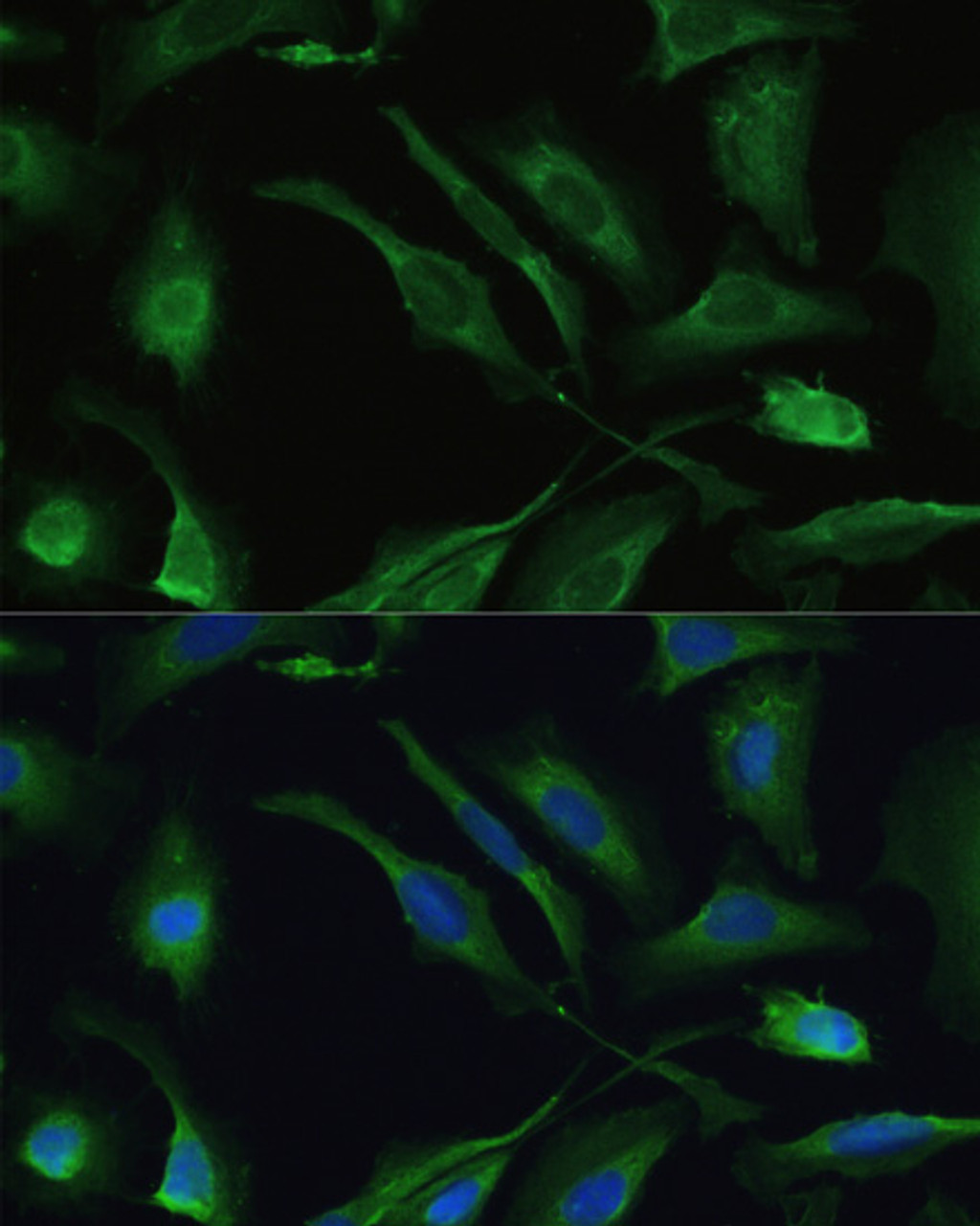 Immunofluorescence analysis of U2OS cells using IL18 antibody (16-736) at dilution of 1:100. Blue: DAPI for nuclear staining.