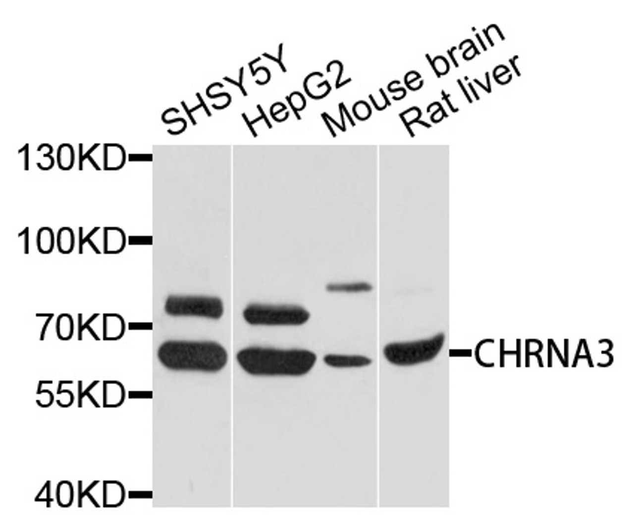 Western blot analysis of extracts of various cell lines, using CHRNA3 antibody (16-738) at 1:1000 dilution.<br/>Secondary antibody: HRP Goat Anti-Rabbit IgG (H+L) at 1:10000 dilution.<br/>Lysates/proteins: 25ug per lane.<br/>Blocking buffer: 3% nonfat dry milk in TBST.<br/>Detection: ECL Basic Kit.<br/>Exposure time: 10s.