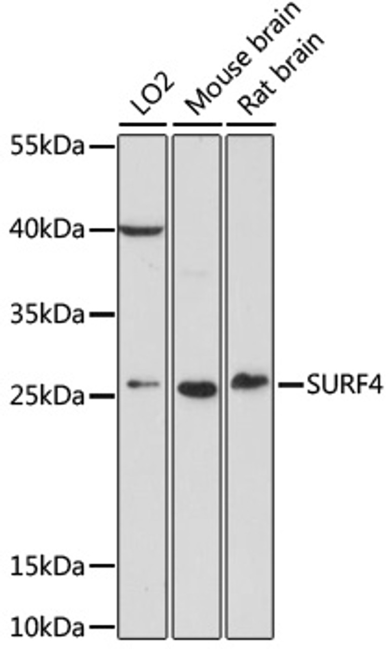 Western blot analysis of extracts of various cell lines, using SURF4 antibody (16-739) at 1:1000 dilution.<br/>Secondary antibody: HRP Goat Anti-Rabbit IgG (H+L) at 1:10000 dilution.<br/>Lysates/proteins: 25ug per lane.<br/>Blocking buffer: 3% nonfat dry milk in TBST.<br/>Detection: ECL Basic Kit.<br/>Exposure time: 10s.