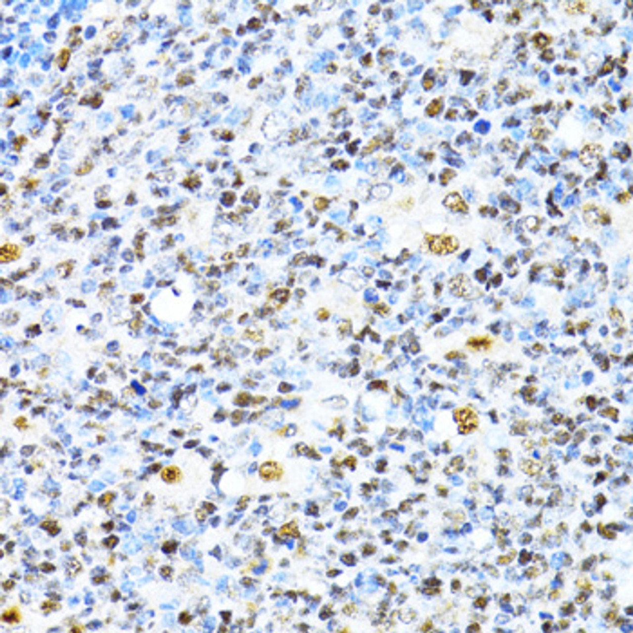Immunohistochemistry of paraffin-embedded human appendix using XRCC4 antibody (16-747) at dilution of 1:100 (40x lens) .