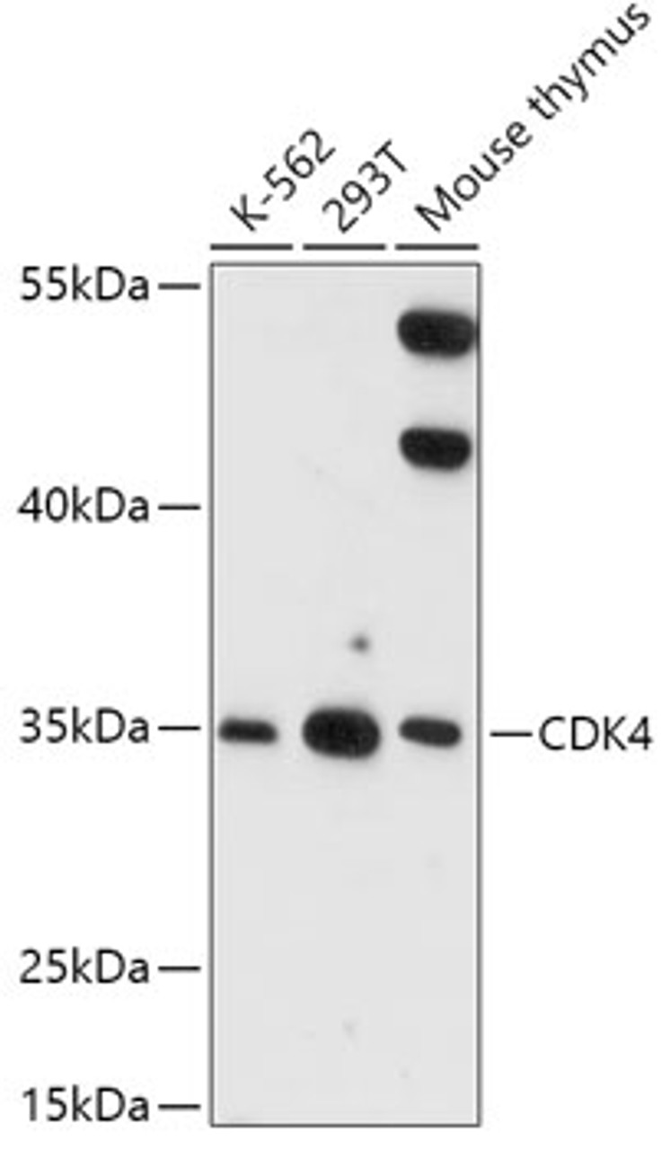Western blot analysis of extracts of various cell lines, using CDK4 antibody (16-759) at 1:1000 dilution.<br/>Secondary antibody: HRP Goat Anti-Rabbit IgG (H+L) at 1:10000 dilution.<br/>Lysates/proteins: 25ug per lane.<br/>Blocking buffer: 3% nonfat dry milk in TBST.<br/>Detection: ECL Basic Kit.<br/>Exposure time: 5s.