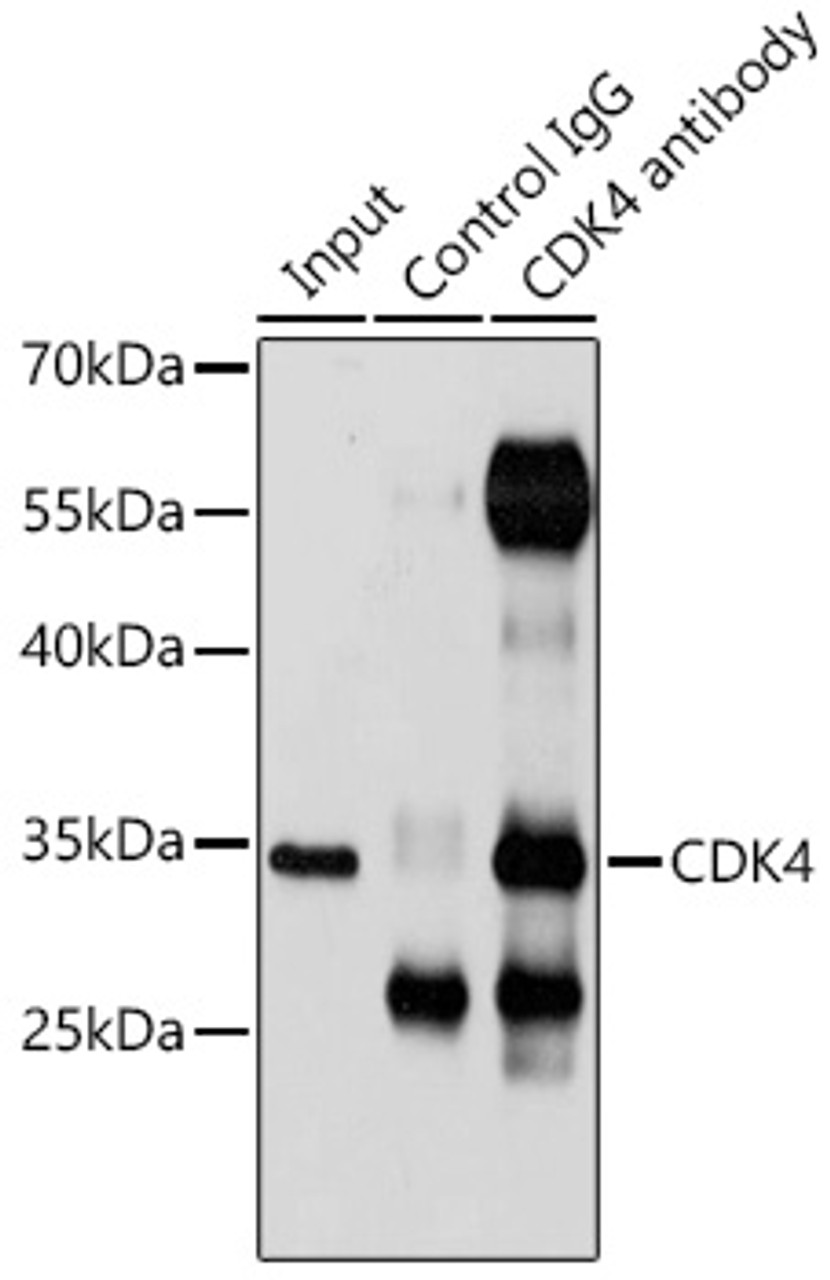 Immunoprecipitation analysis of 200ug extracts of 293T cells using 3ug CDK4 antibody (16-759) . Western blot was performed from the immunoprecipitate using CDK4 antibody (16-759) at a dilition of 1:1000.