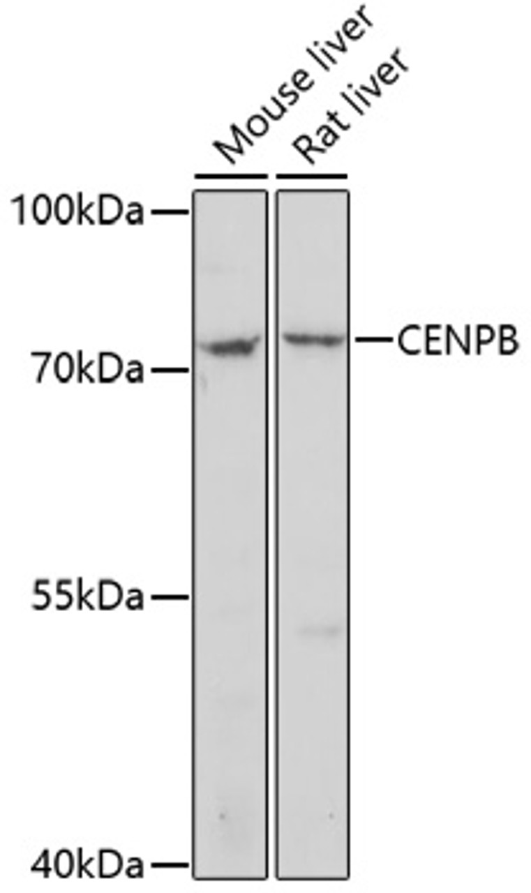 Western blot analysis of extracts of various cell lines, using CENPB antibody (16-761) at 1:1000 dilution.<br/>Secondary antibody: HRP Goat Anti-Rabbit IgG (H+L) at 1:10000 dilution.<br/>Lysates/proteins: 25ug per lane.<br/>Blocking buffer: 3% nonfat dry milk in TBST.<br/>Detection: ECL Basic Kit.<br/>Exposure time: 5min.