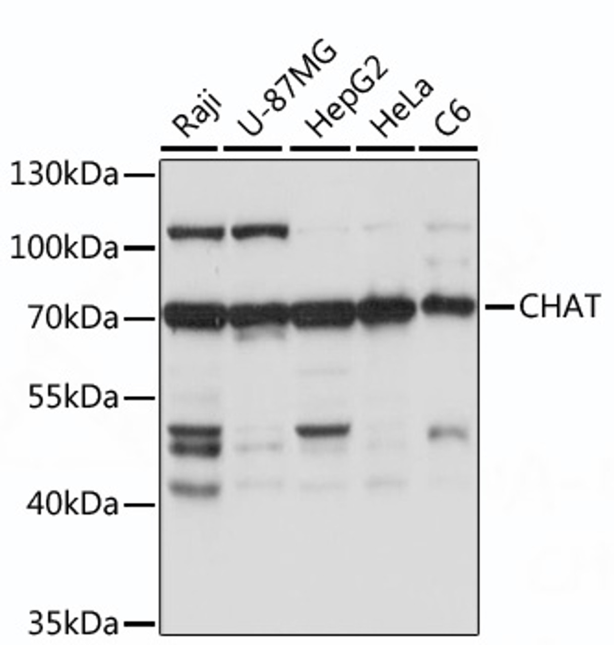 Western blot analysis of extracts of various cell line, using CHAT antibody (16-762) at 1:1000 dilution.<br/>Secondary antibody: HRP Goat Anti-Rabbit IgG (H+L) at 1:10000 dilution.<br/>Lysates/proteins: 25ug per lane.<br/>Blocking buffer: 3% nonfat dry milk in TBST.<br/>Detection: ECL Basic Kit.<br/>Exposure time: 5s.