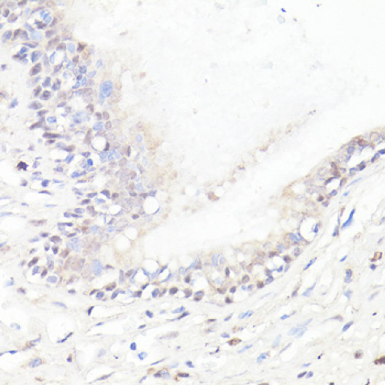 Immunohistochemistry of paraffin-embedded human lung using DMP1 antibody (16-767) at dilution of 1:100 (40x lens) .