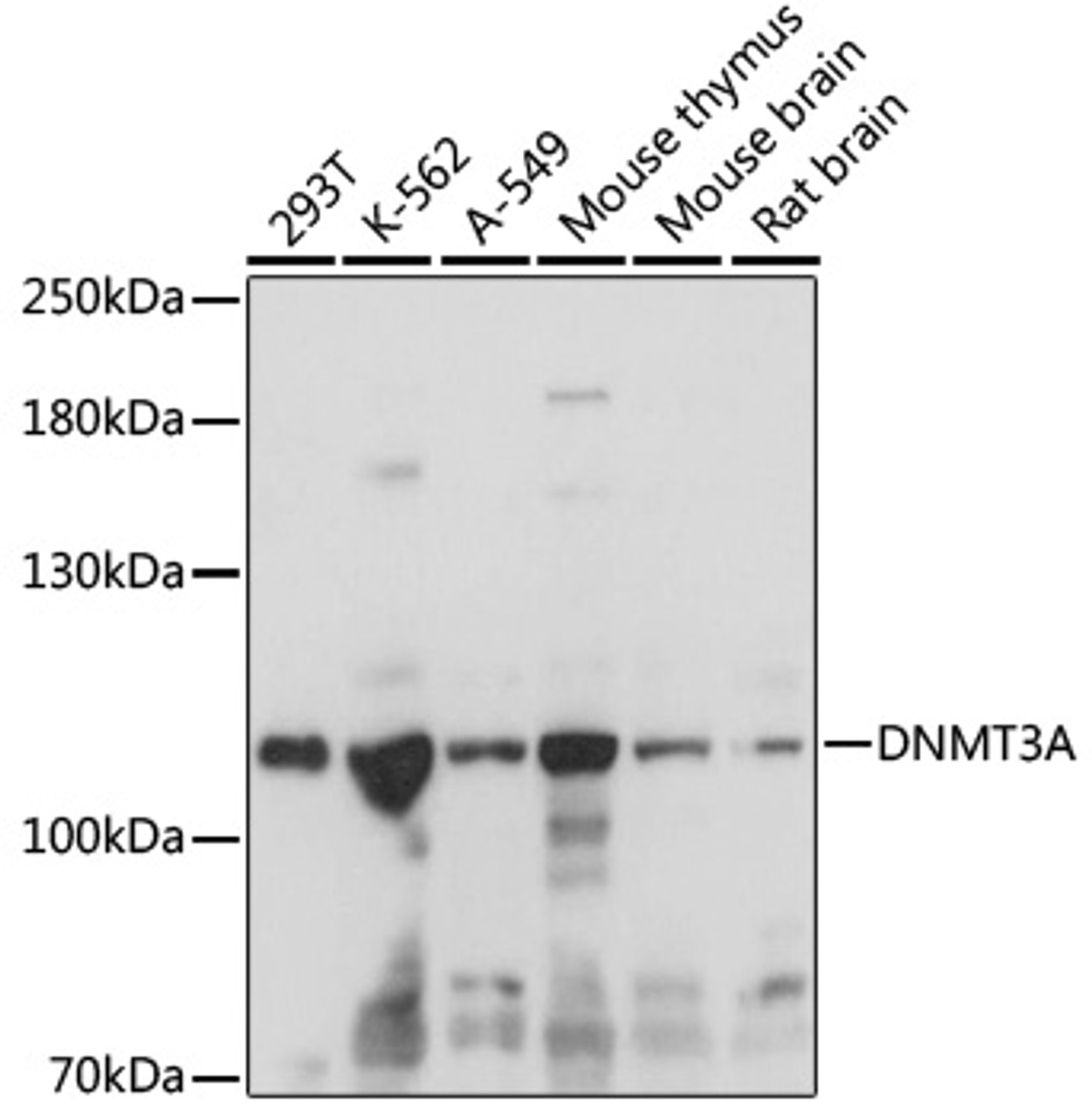 Western blot analysis of extracts of various cell lines, using DNMT3A antibody (16-769) at 1:1000 dilution.<br/>Secondary antibody: HRP Goat Anti-Rabbit IgG (H+L) at 1:10000 dilution.<br/>Lysates/proteins: 25ug per lane.<br/>Blocking buffer: 3% nonfat dry milk in TBST.<br/>Detection: ECL Basic Kit.<br/>Exposure time: 1s.