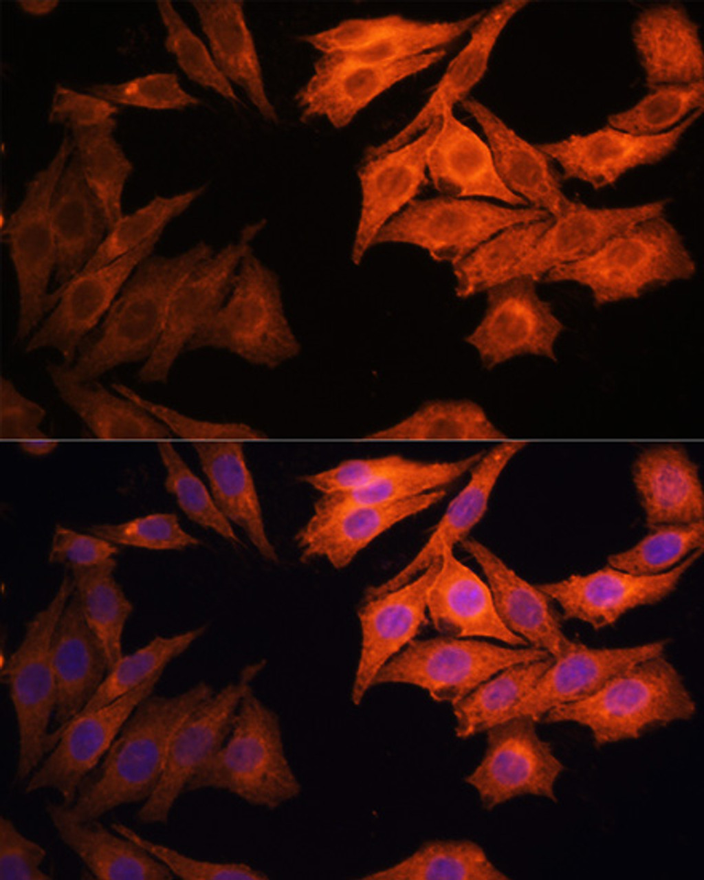 Immunofluorescence analysis of HeLa cells using EGFR antibody (16-770) at dilution of 1:100. Blue: DAPI for nuclear staining.