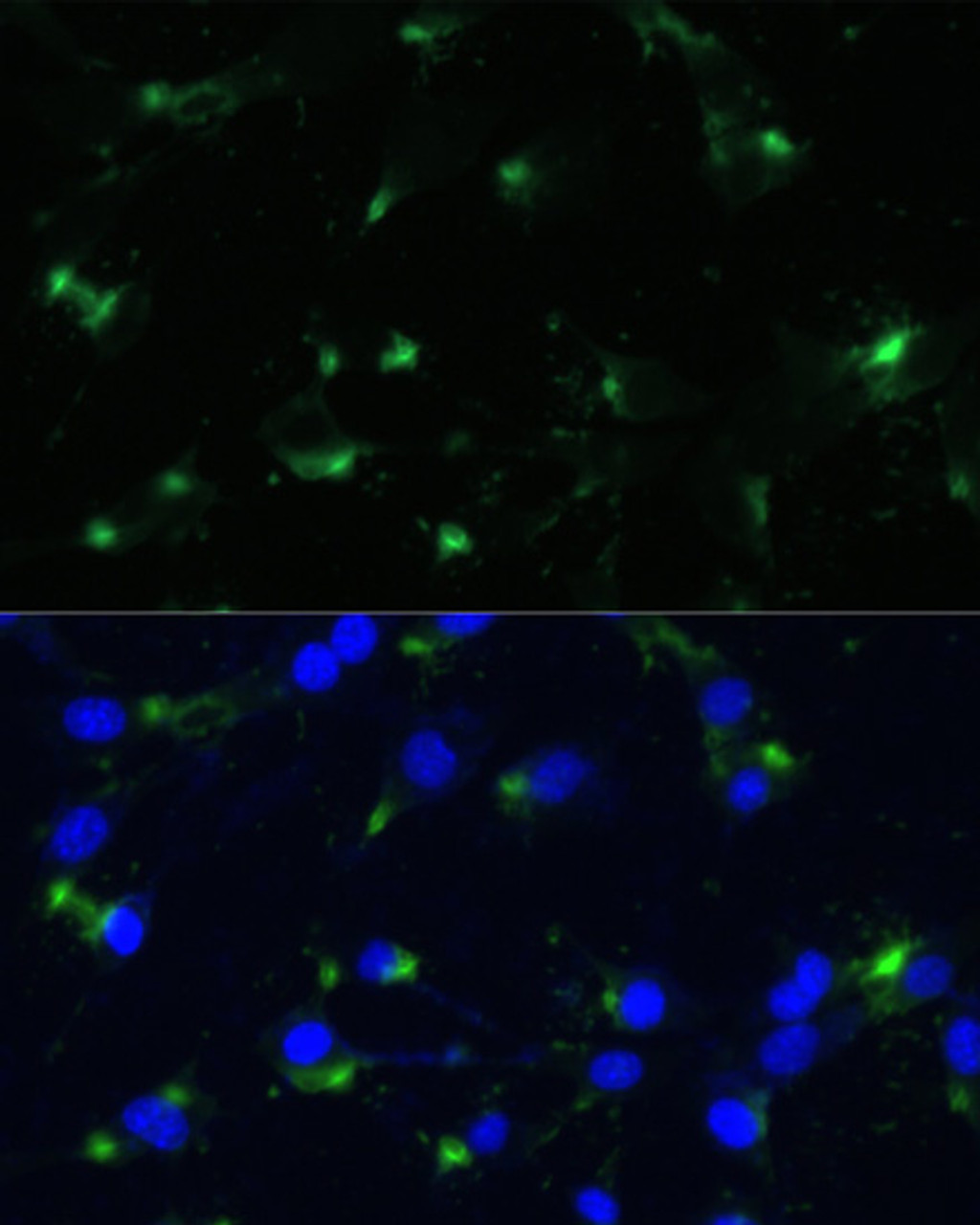 Immunofluorescence analysis of NIH-3T3 cells using ENO1 antibody (16-771) at dilution of 1:100. Blue: DAPI for nuclear staining.