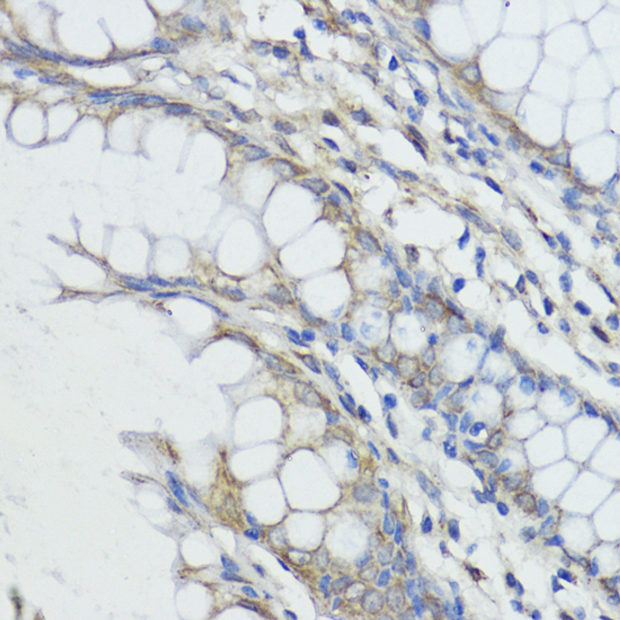 Immunohistochemistry of paraffin-embedded human colon using FXN / Frataxin antibody (16-775) at dilution of 1:100 (40x lens) .