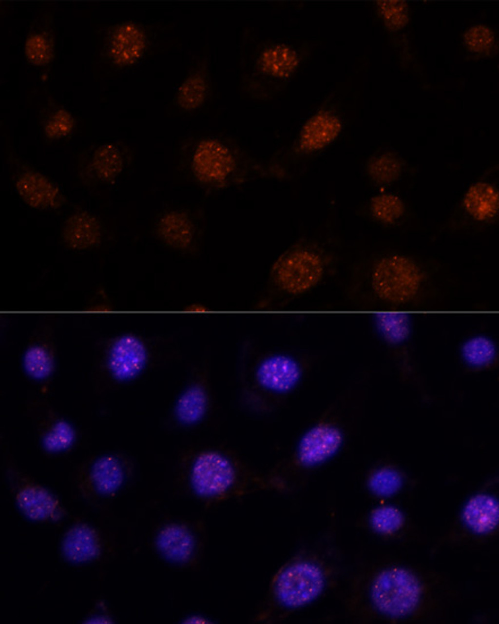 Immunofluorescence analysis of L-929 cells using GLI2 antibody (16-777) at dilution of 1:100. Blue: DAPI for nuclear staining.