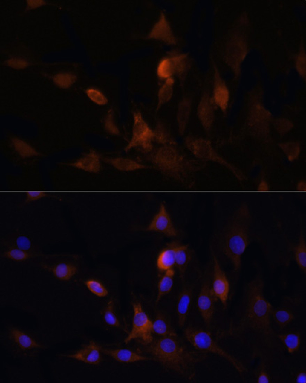 Immunofluorescence analysis of C6 cells using HMGCR antibody (16-783) at dilution of 1:100. Blue: DAPI for nuclear staining.