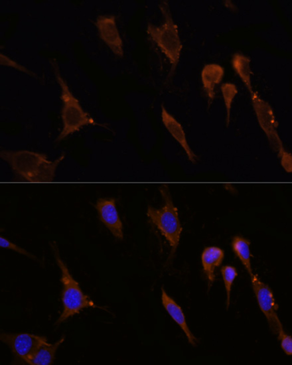 Immunofluorescence analysis of NIH/3T3 cells using HMGCR antibody (16-783) at dilution of 1:100. Blue: DAPI for nuclear staining.