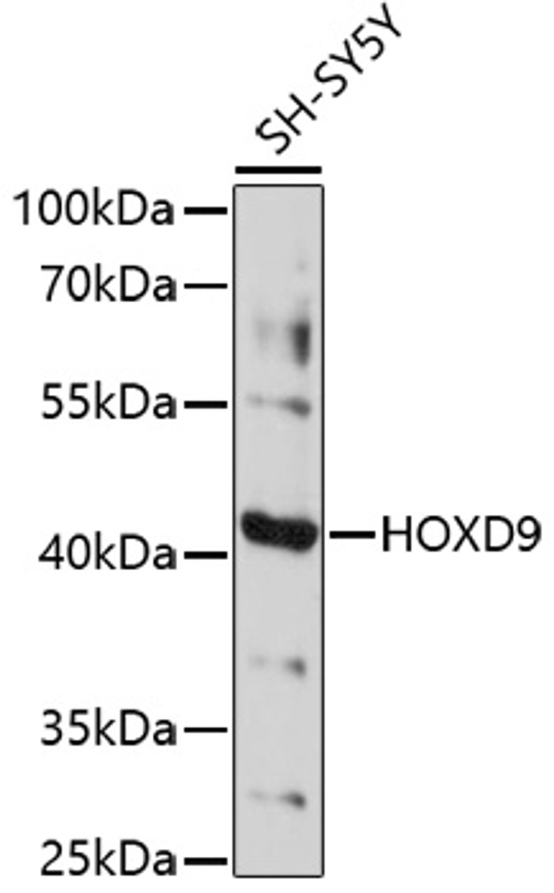 Western blot analysis of extracts of SH-SY5Y cells, using HOXD9 antibody (16-784) at 1:1000 dilution.<br/>Secondary antibody: HRP Goat Anti-Rabbit IgG (H+L) at 1:10000 dilution.<br/>Lysates/proteins: 25ug per lane.<br/>Blocking buffer: 3% nonfat dry milk in TBST.<br/>Detection: ECL Basic Kit.<br/>Exposure time: 5s.
