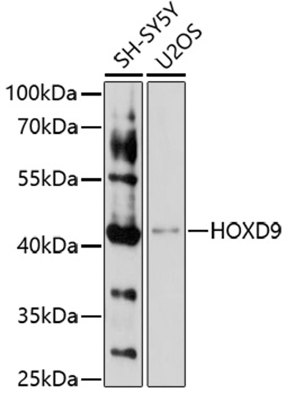 Western blot analysis of extracts of various cell lines, using HOXD9 antibody (16-784) at 1:1000 dilution.<br/>Secondary antibody: HRP Goat Anti-Rabbit IgG (H+L) at 1:10000 dilution.<br/>Lysates/proteins: 25ug per lane.<br/>Blocking buffer: 3% nonfat dry milk in TBST.<br/>Detection: ECL Basic Kit.<br/>Exposure time: 10s.