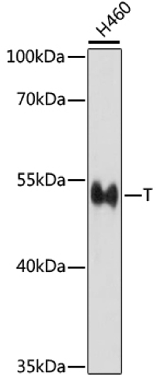 Western blot analysis of extracts of H460 cells, using T antibody (16-788) at 1:1000 dilution.<br/>Secondary antibody: HRP Goat Anti-Rabbit IgG (H+L) at 1:10000 dilution.<br/>Lysates/proteins: 25ug per lane.<br/>Blocking buffer: 3% nonfat dry milk in TBST.<br/>Detection: ECL Basic Kit.<br/>Exposure time: 30s.