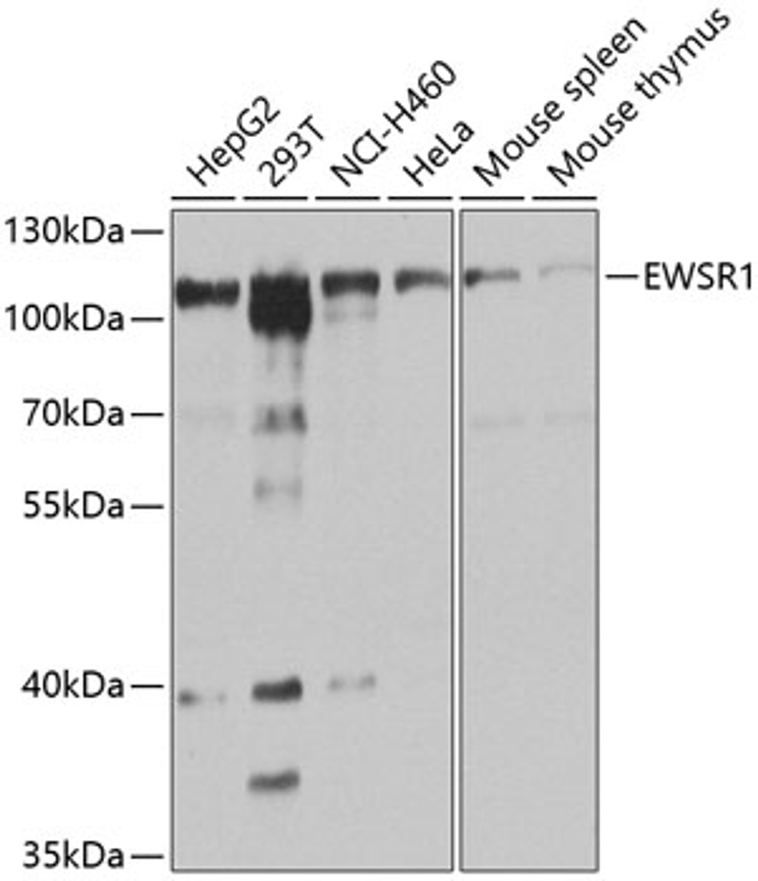 Western blot analysis of extracts of various cell lines, using EWSR1 Antibody (16-791) at 1:1000 dilution.<br/>Secondary antibody: HRP Goat Anti-Rabbit IgG (H+L) at 1:10000 dilution.<br/>Lysates/proteins: 25ug per lane.<br/>Blocking buffer: 3% nonfat dry milk in TBST.<br/>Detection: ECL Basic Kit.<br/>Exposure time: 1s.