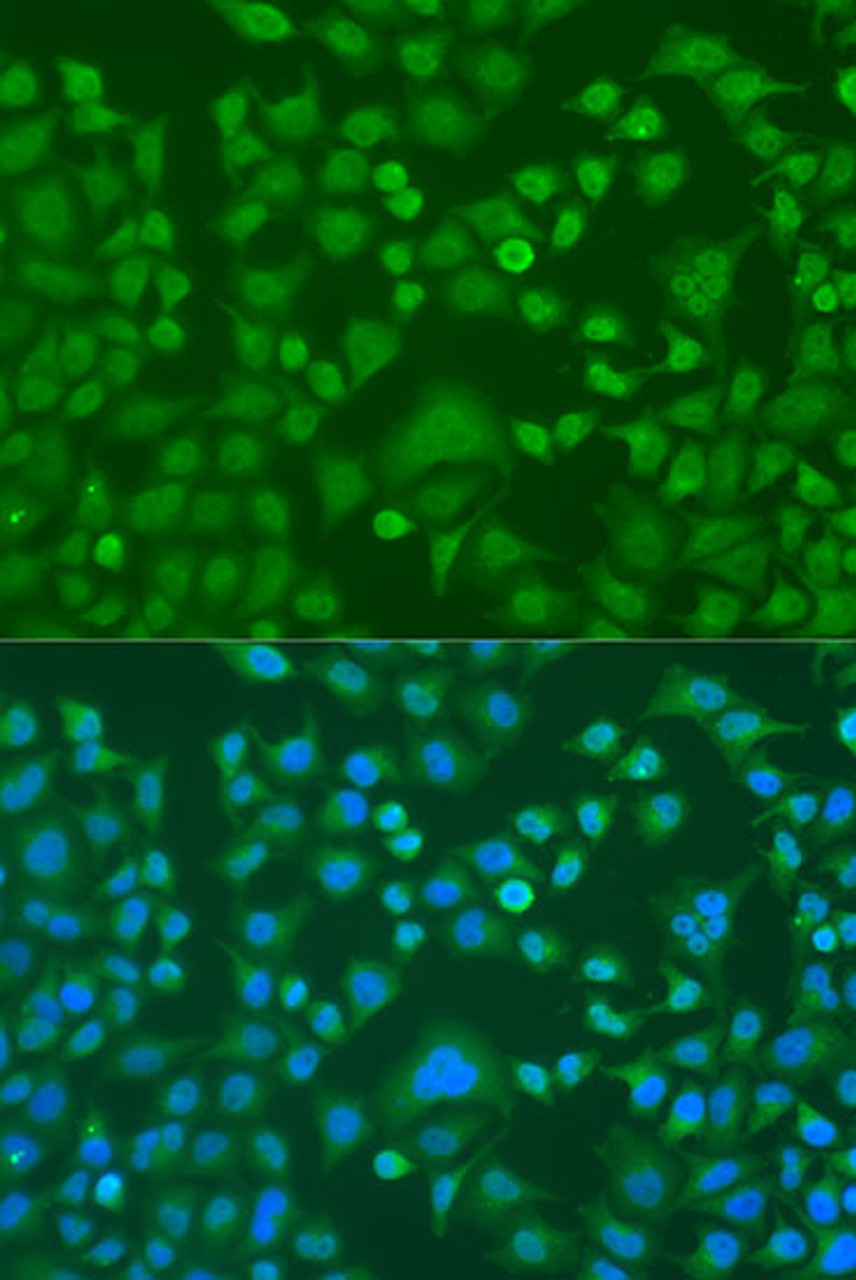 Immunofluorescence analysis of U2OS cells using EWSR1 antibody (16-791) at dilution of 1:100. Blue: DAPI for nuclear staining.