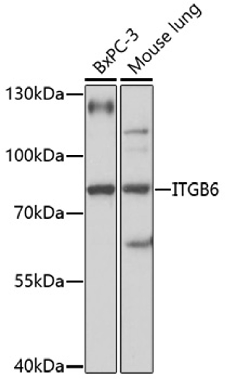 Western blot analysis of extracts of various cell lines, using ITGB6 antibody (16-792) at 1:1000 dilution.<br/>Secondary antibody: HRP Goat Anti-Rabbit IgG (H+L) at 1:10000 dilution.<br/>Lysates/proteins: 25ug per lane.<br/>Blocking buffer: 3% nonfat dry milk in TBST.<br/>Detection: ECL Basic Kit.<br/>Exposure time: 15s.