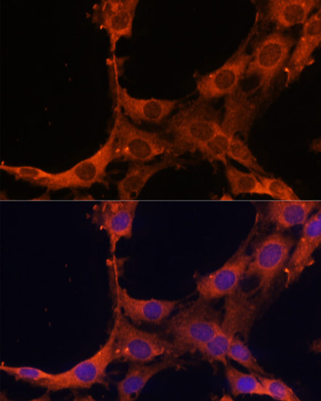 Immunofluorescence analysis of C6 cells using SMAD2 antibody (16-795) at dilution of 1:100. Blue: DAPI for nuclear staining.