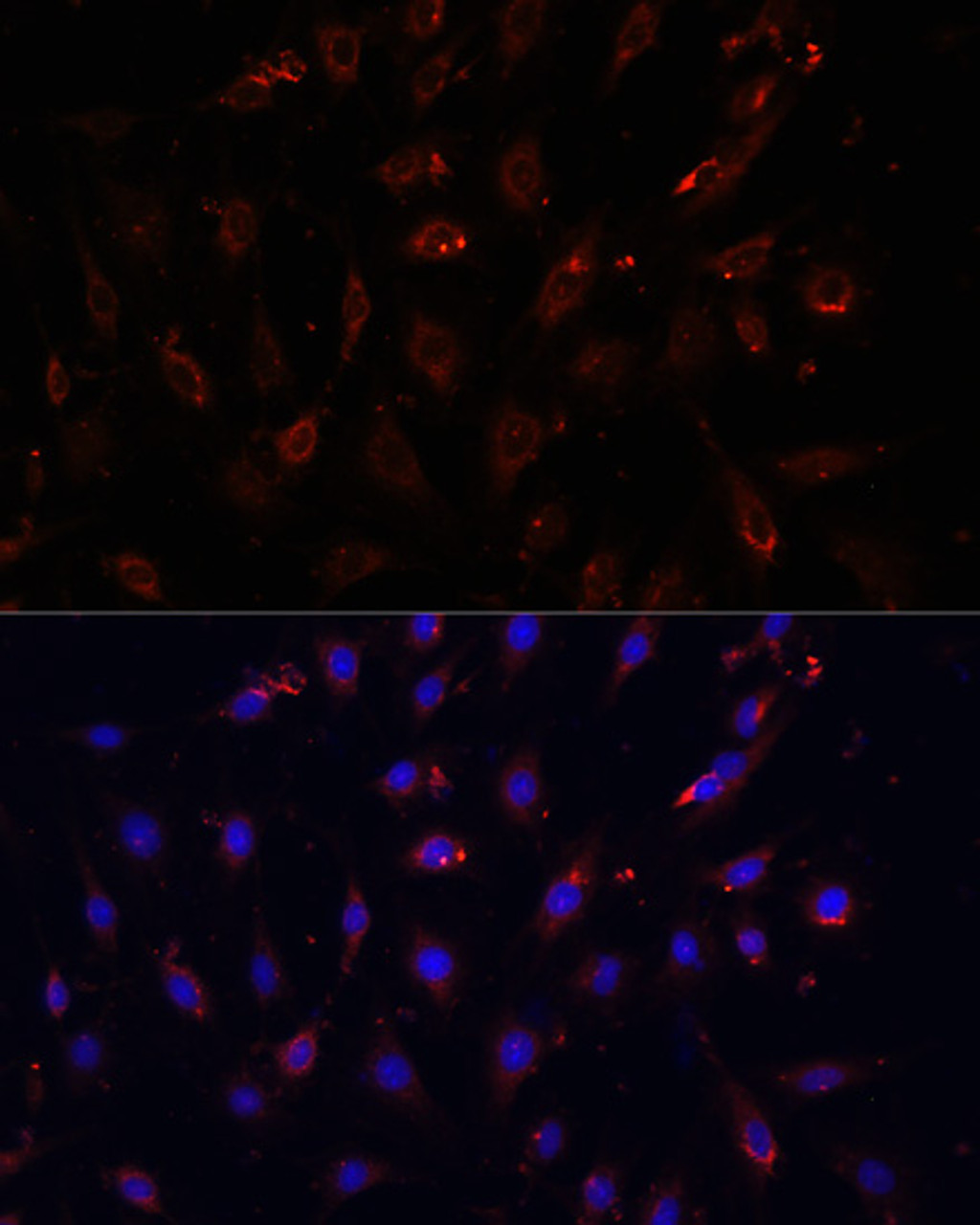 Immunofluorescence analysis of C6 cells using NFKBIA antibody (16-804) at dilution of 1:100. Blue: DAPI for nuclear staining.