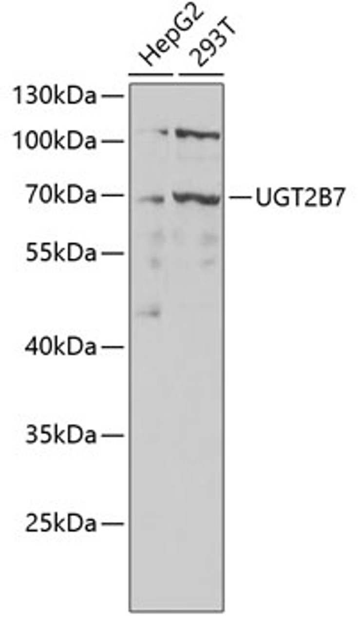 Western blot analysis of extracts of various cell lines, using UGT2B7 antibody (16-805) at 1:1000 dilution.<br/>Secondary antibody: HRP Goat Anti-Rabbit IgG (H+L) at 1:10000 dilution.<br/>Lysates/proteins: 25ug per lane.<br/>Blocking buffer: 3% nonfat dry milk in TBST.