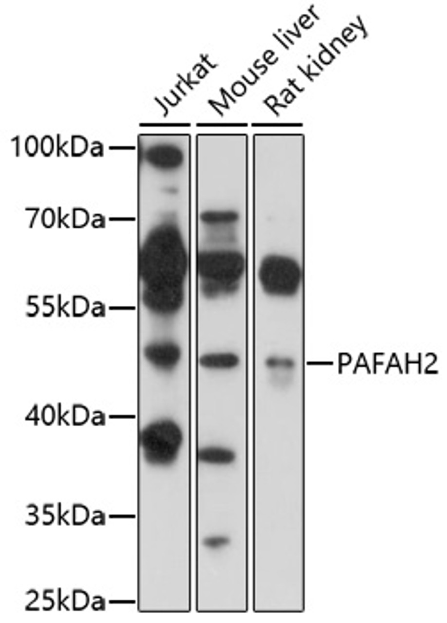 Western blot analysis of extracts of various cell lines, using PAFAH2 antibody (16-808) at 1:1000 dilution.<br/>Secondary antibody: HRP Goat Anti-Rabbit IgG (H+L) at 1:10000 dilution.<br/>Lysates/proteins: 25ug per lane.<br/>Blocking buffer: 3% nonfat dry milk in TBST.<br/>Detection: ECL Basic Kit.<br/>Exposure time: 15s.