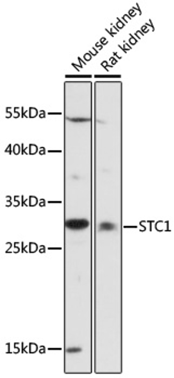 Western blot analysis of extracts of various cell lines, using STC1 antibody (16-820) at 1:1000 dilution.<br/>Secondary antibody: HRP Goat Anti-Rabbit IgG (H+L) at 1:10000 dilution.<br/>Lysates/proteins: 25ug per lane.<br/>Blocking buffer: 3% nonfat dry milk in TBST.<br/>Detection: ECL Basic Kit.<br/>Exposure time: 90s.