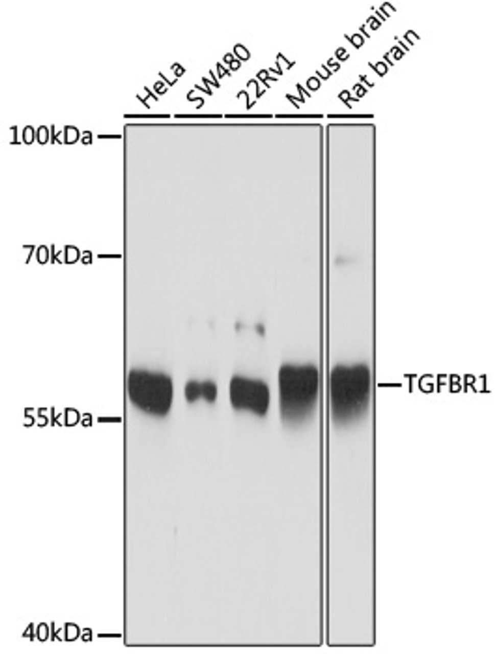 Western blot analysis of extracts of various cell lines, using TGFBR1 antibody (16-823) at 1:1000 dilution.<br/>Secondary antibody: HRP Goat Anti-Rabbit IgG (H+L) at 1:10000 dilution.<br/>Lysates/proteins: 25ug per lane.<br/>Blocking buffer: 3% nonfat dry milk in TBST.<br/>Detection: ECL Basic Kit.<br/>Exposure time: 30s.