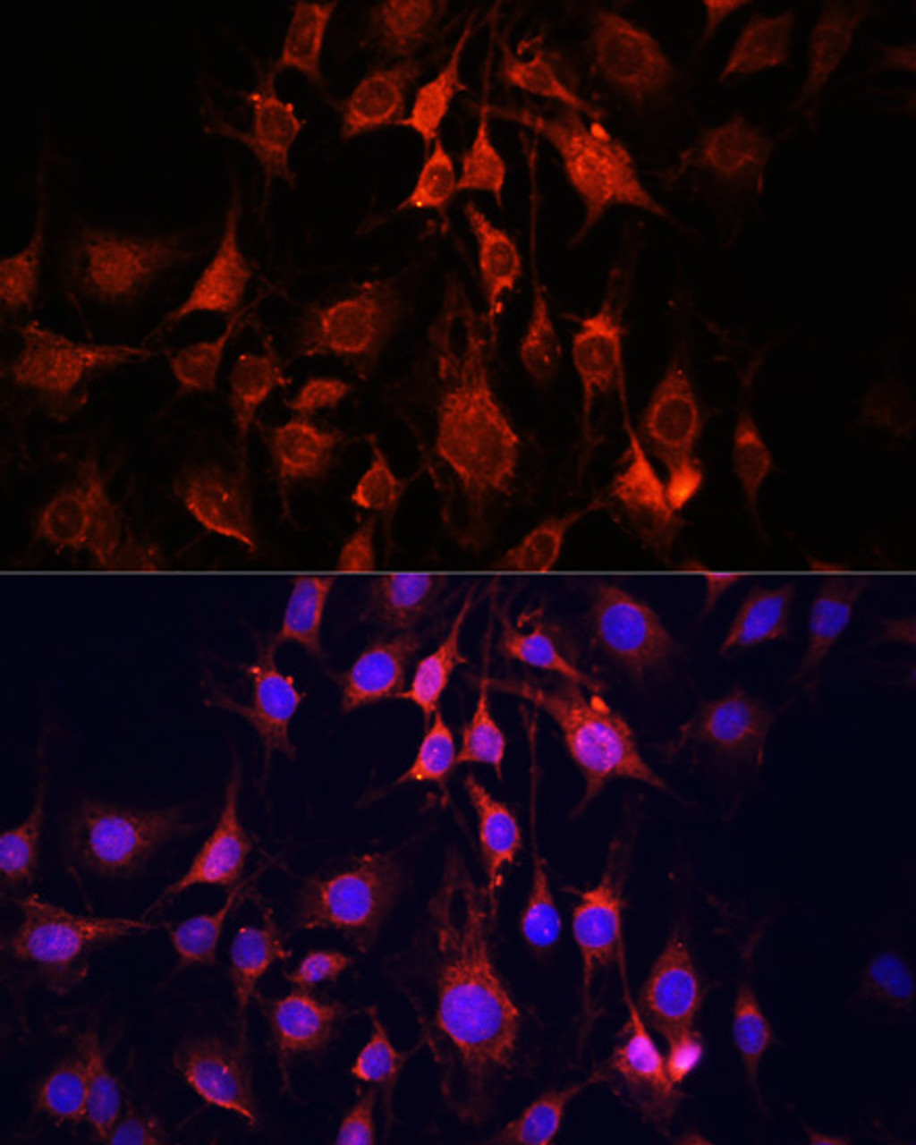 Immunofluorescence analysis of C6 cells using UCP3 antibody (16-826) at dilution of 1:100. Blue: DAPI for nuclear staining.