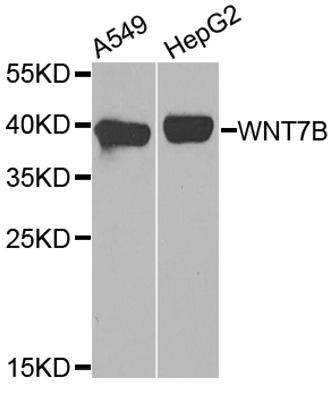 Western blot analysis of extracts of various cell lines, using WNT7B antibody (16-831) at 1:1000 dilution.<br/>Secondary antibody: HRP Goat Anti-Rabbit IgG (H+L) at 1:10000 dilution.<br/>Lysates/proteins: 25ug per lane.<br/>Blocking buffer: 3% nonfat dry milk in TBST.<br/>Detection: ECL Basic Kit.<br/>Exposure time: 90s.