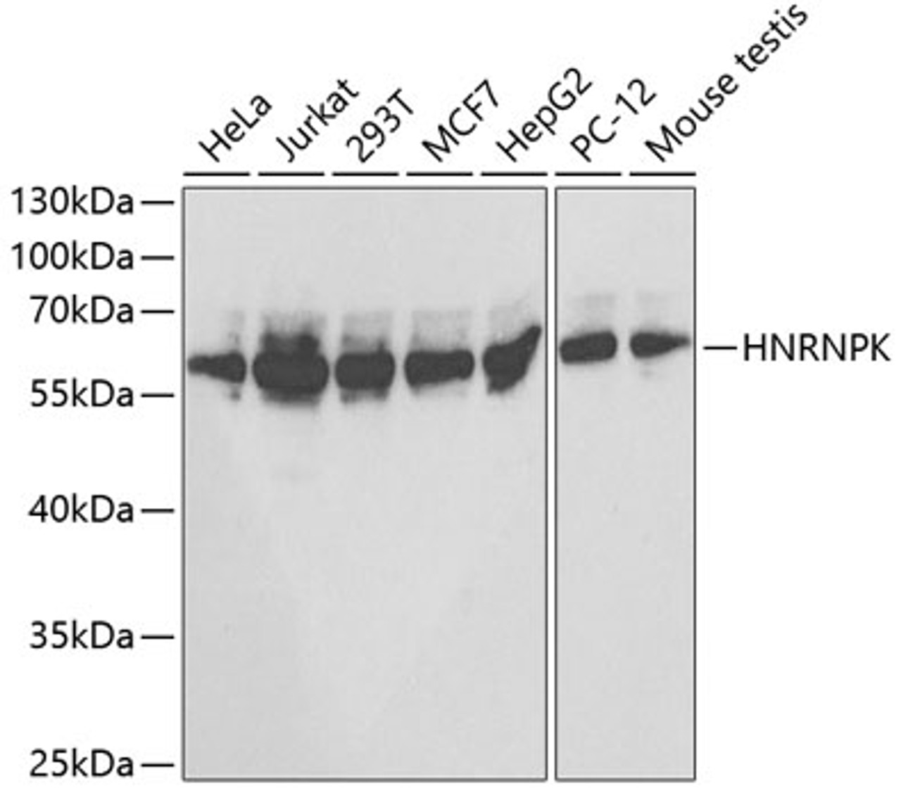 Western blot analysis of extracts of various cell lines, using HNRNPK antibody (16-835) at 1:1000 dilution.<br/>Secondary antibody: HRP Goat Anti-Rabbit IgG (H+L) at 1:10000 dilution.<br/>Lysates/proteins: 25ug per lane.<br/>Blocking buffer: 3% nonfat dry milk in TBST.