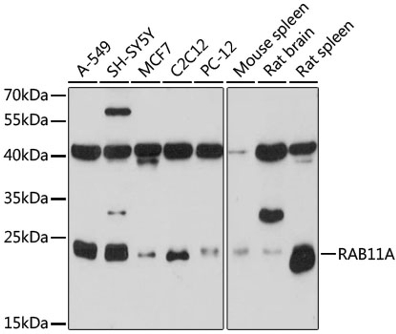 Western blot analysis of extracts of various cell lines, using RAB11A antibody (16-841) at 1:1000 dilution.<br/>Secondary antibody: HRP Goat Anti-Rabbit IgG (H+L) at 1:10000 dilution.<br/>Lysates/proteins: 25ug per lane.<br/>Blocking buffer: 3% nonfat dry milk in TBST.<br/>Detection: ECL Basic Kit.<br/>Exposure time: 15s.