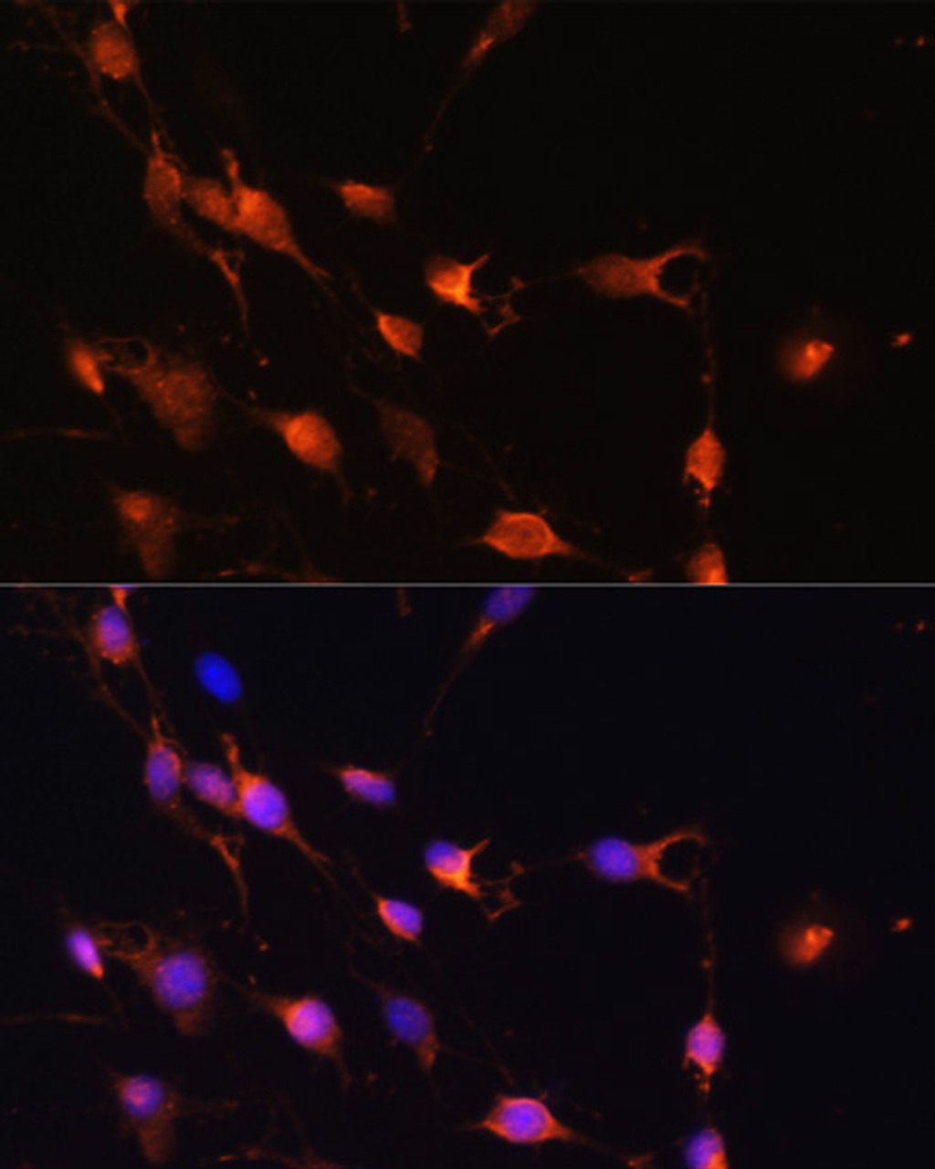 Immunofluorescence analysis of C6 cells using RAB11A antibody (16-841) at dilution of 1:100. Blue: DAPI for nuclear staining.