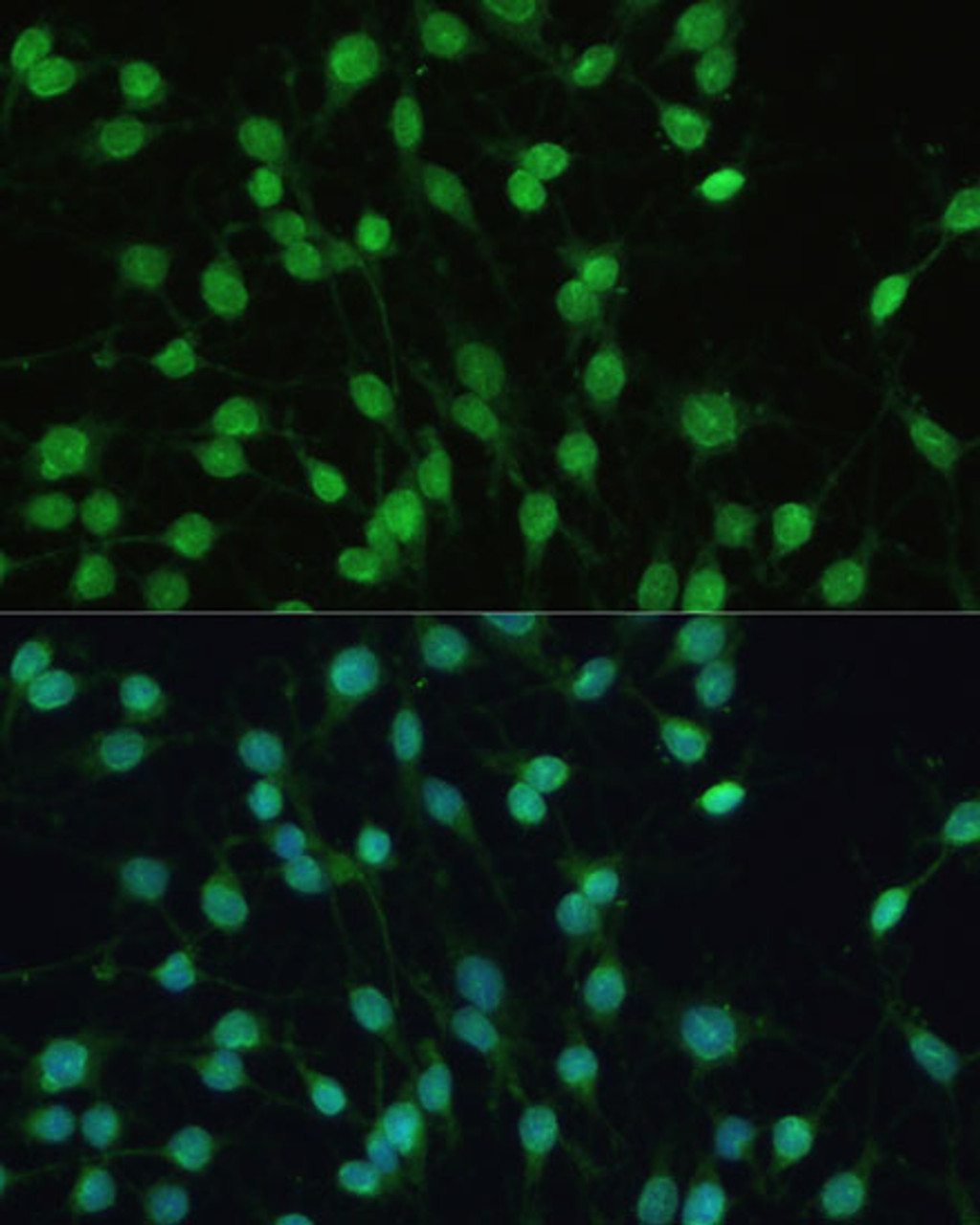 Immunofluorescence analysis of C6 cells using PXR Polyclonal Antibody (16-843) at dilution of 1:100 (40x lens) . Blue: DAPI for nuclear staining.