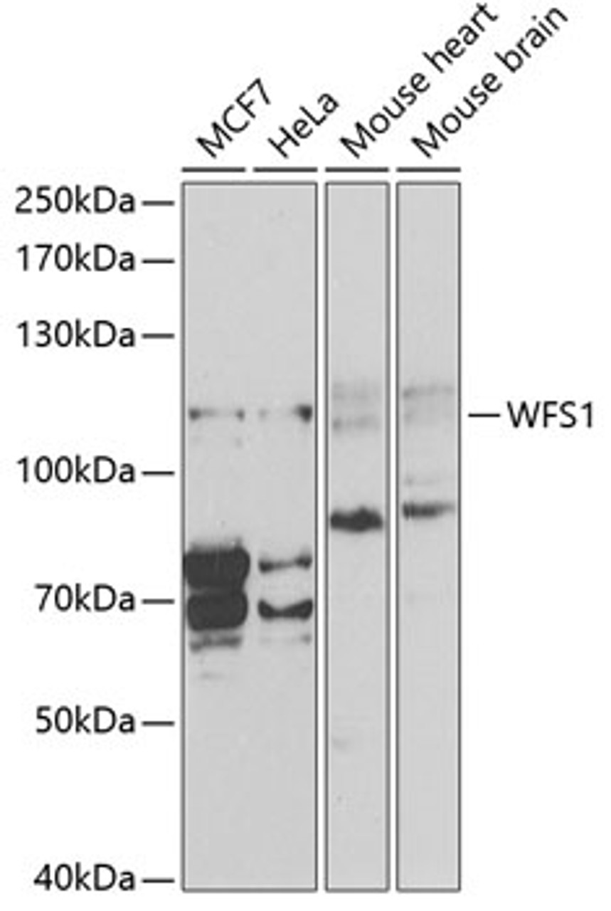 Western blot analysis of extracts of various cell lines, using WFS1 antibody (16-845) at 1:1000 dilution.<br/>Secondary antibody: HRP Goat Anti-Rabbit IgG (H+L) at 1:10000 dilution.<br/>Lysates/proteins: 25ug per lane.<br/>Blocking buffer: 3% nonfat dry milk in TBST.