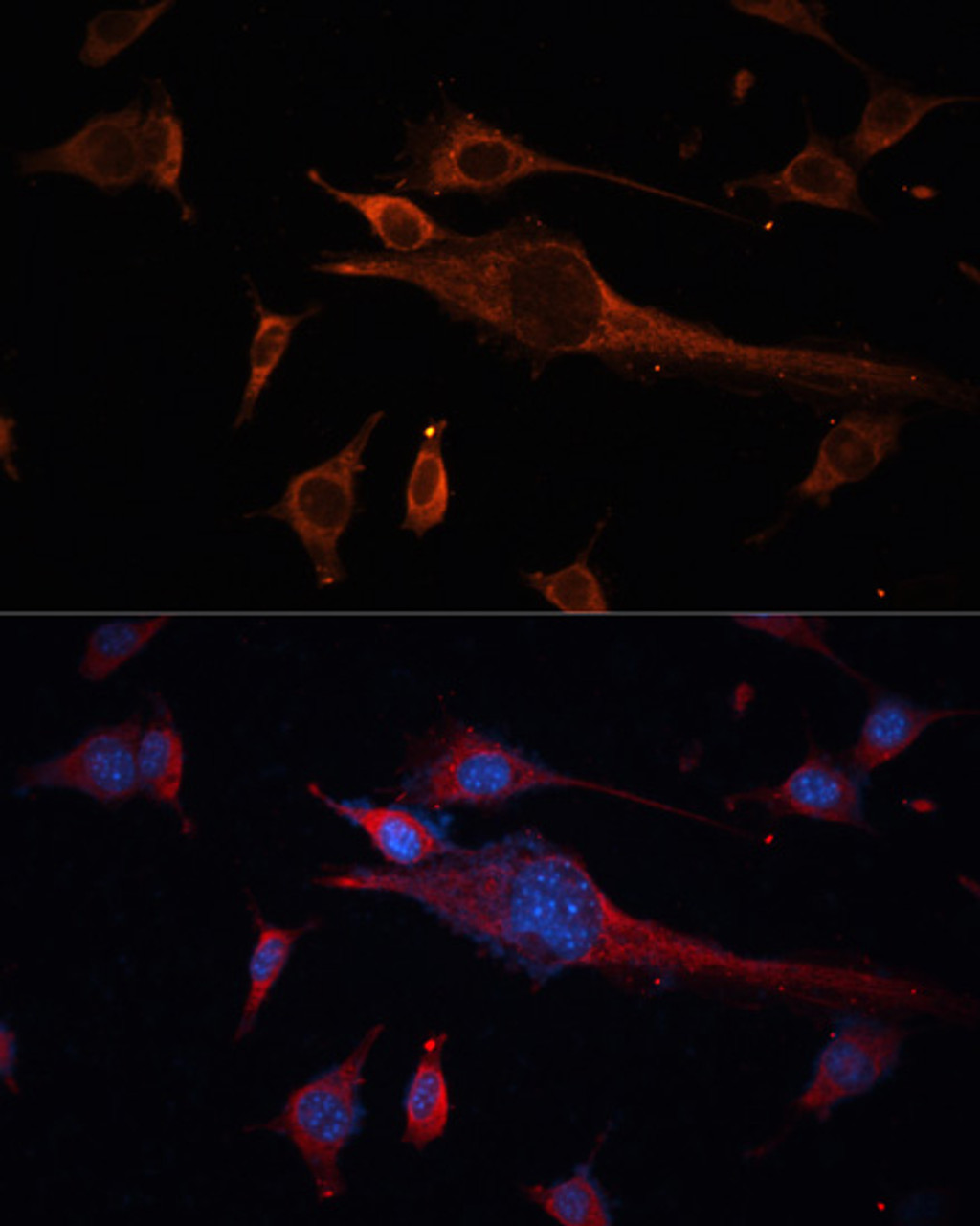 Immunofluorescence analysis of NIH/3T3 cells using TUBB3 antibody (16-851) at dilution of 1:100. Blue: DAPI for nuclear staining.