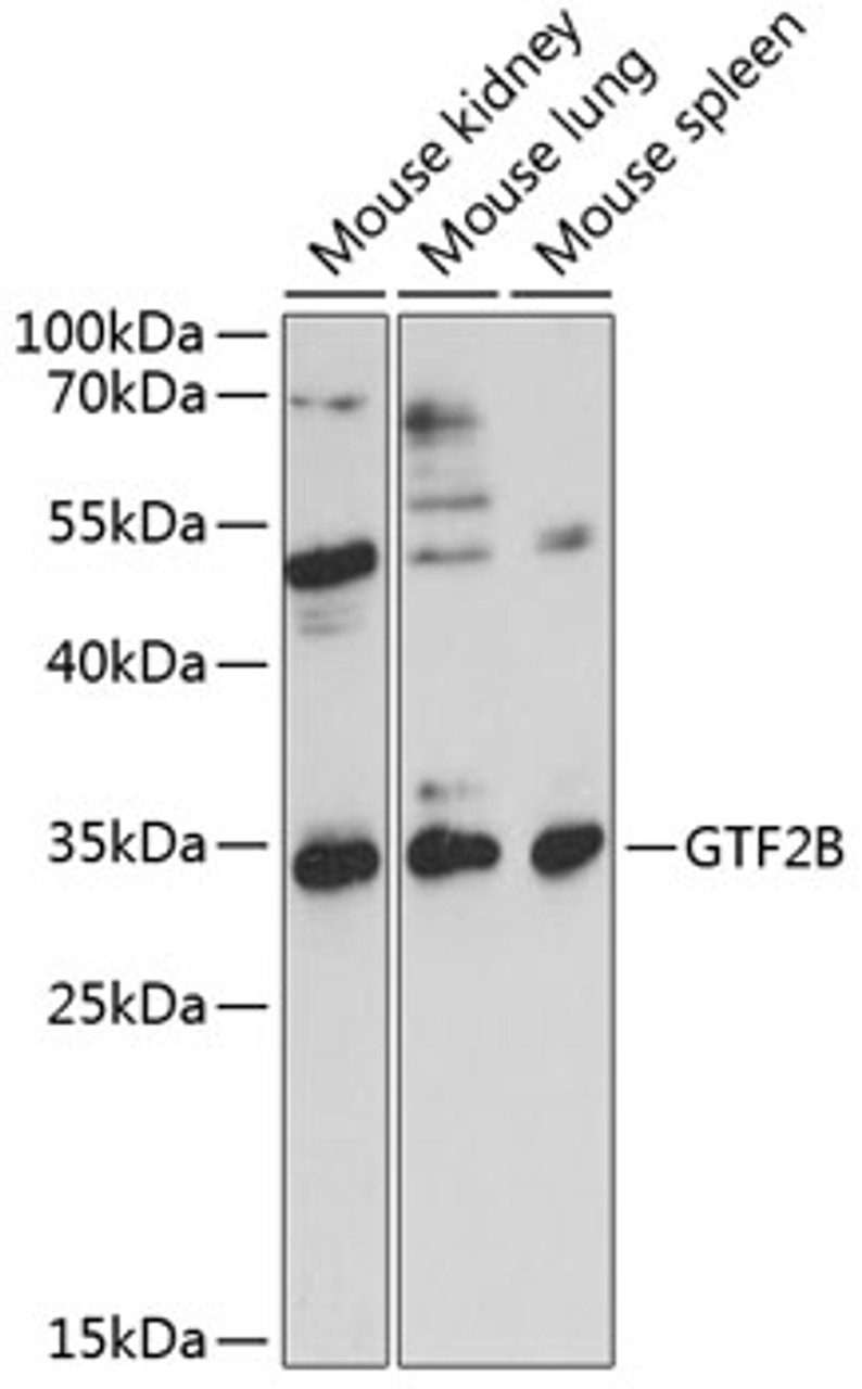 Western blot analysis of extracts of various cell lines, using GTF2B antibody (16-857) at 1:1000 dilution.<br/>Secondary antibody: HRP Goat Anti-Rabbit IgG (H+L) at 1:10000 dilution.<br/>Lysates/proteins: 25ug per lane.<br/>Blocking buffer: 3% nonfat dry milk in TBST.<br/>Detection: ECL Basic Kit.<br/>Exposure time: 30s.