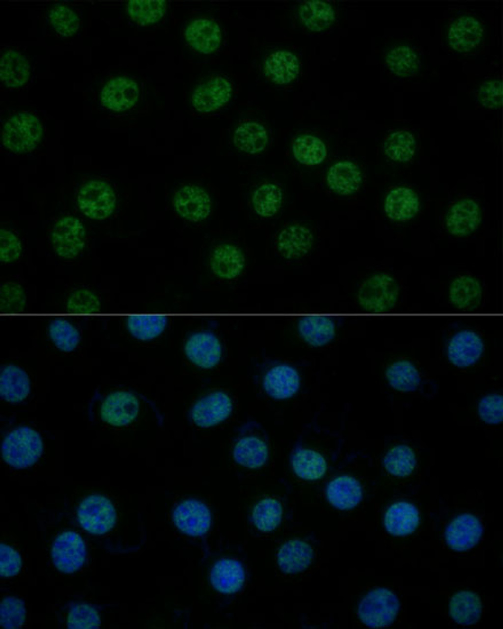 Immunofluorescence analysis of L929 cells using GTF2B Polyclonal Antibody (16-857) at dilution of 1:100 (40x lens) . Blue: DAPI for nuclear staining.