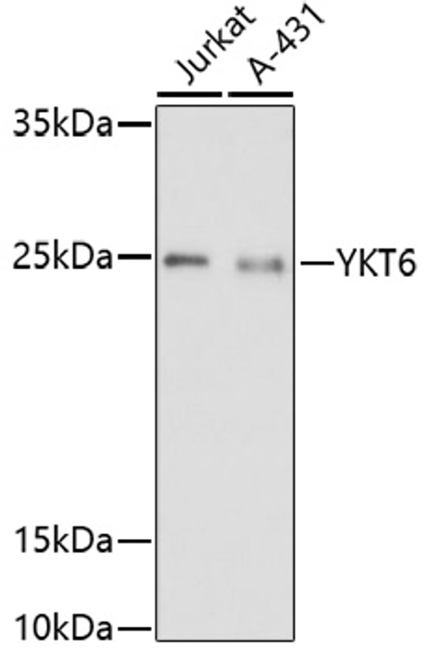 Western blot analysis of extracts of various cell lines, using YKT6 antibody (16-859) at 1:1000 dilution.<br/>Secondary antibody: HRP Goat Anti-Rabbit IgG (H+L) at 1:10000 dilution.<br/>Lysates/proteins: 25ug per lane.<br/>Blocking buffer: 3% nonfat dry milk in TBST.<br/>Detection: ECL Basic Kit.<br/>Exposure time: 3min.