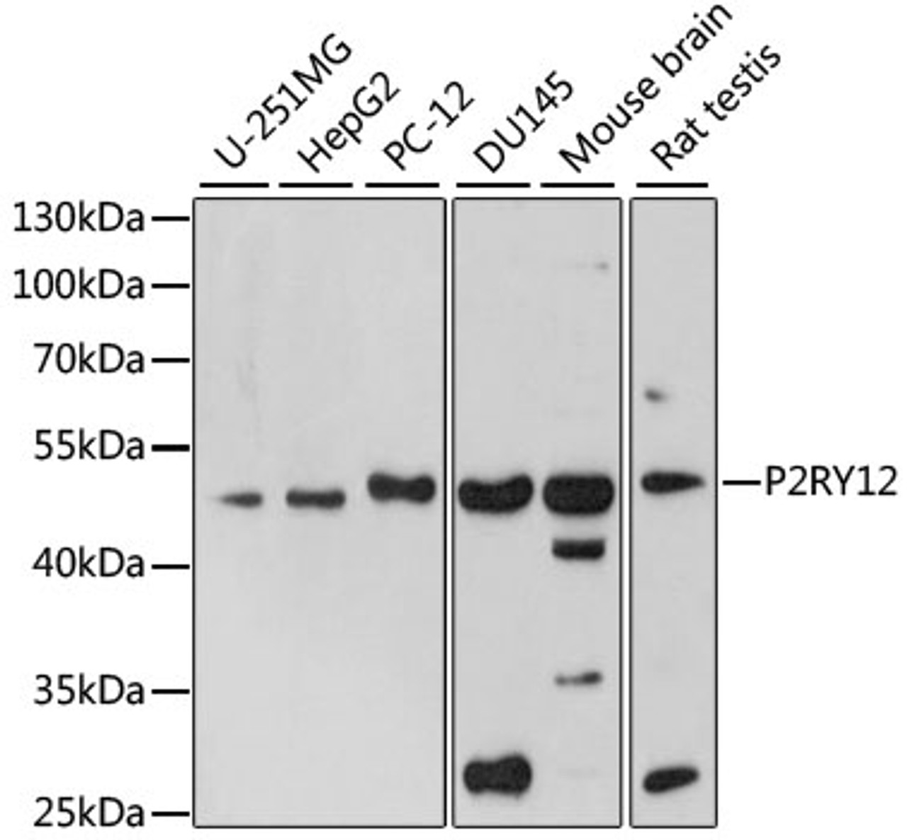 Western blot analysis of extracts of various cell lines, using P2RY12 antibody (16-866) at 1:1000 dilution.<br/>Secondary antibody: HRP Goat Anti-Rabbit IgG (H+L) at 1:10000 dilution.<br/>Lysates/proteins: 25ug per lane.<br/>Blocking buffer: 3% nonfat dry milk in TBST.<br/>Detection: ECL Basic Kit.<br/>Exposure time: 180s.