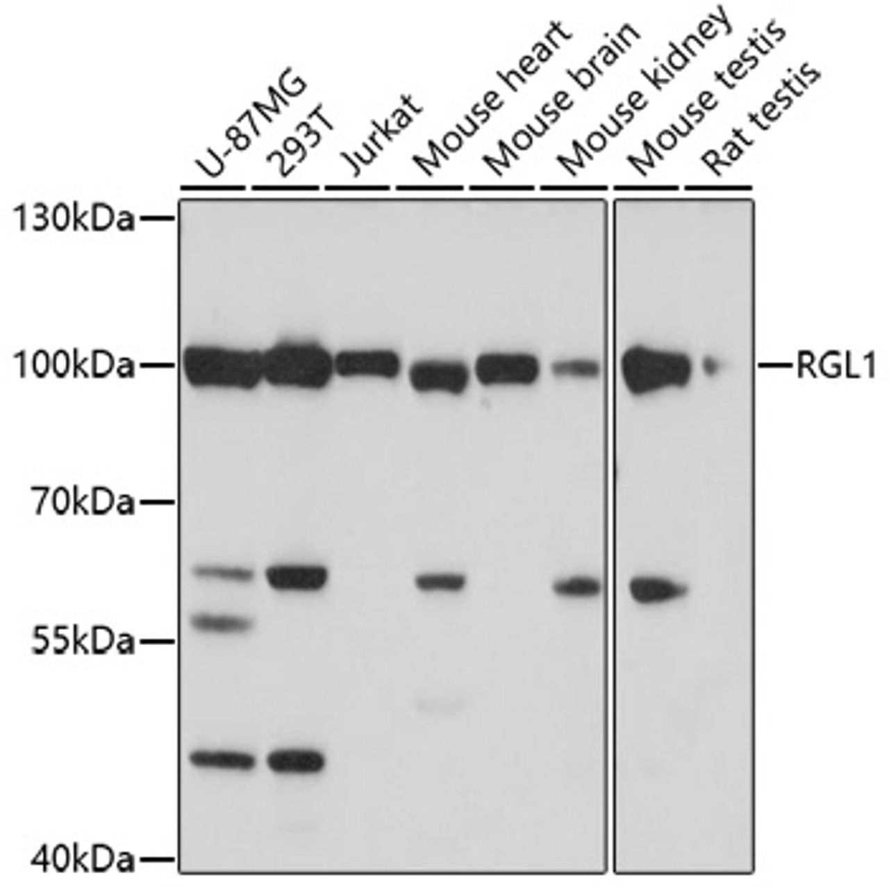 Western blot analysis of extracts of various cell lines, using RGL1 antibody (16-868) at 1:1000 dilution.<br/>Secondary antibody: HRP Goat Anti-Rabbit IgG (H+L) at 1:10000 dilution.<br/>Lysates/proteins: 25ug per lane.<br/>Blocking buffer: 3% nonfat dry milk in TBST.<br/>Detection: ECL Basic Kit.<br/>Exposure time: 30s.