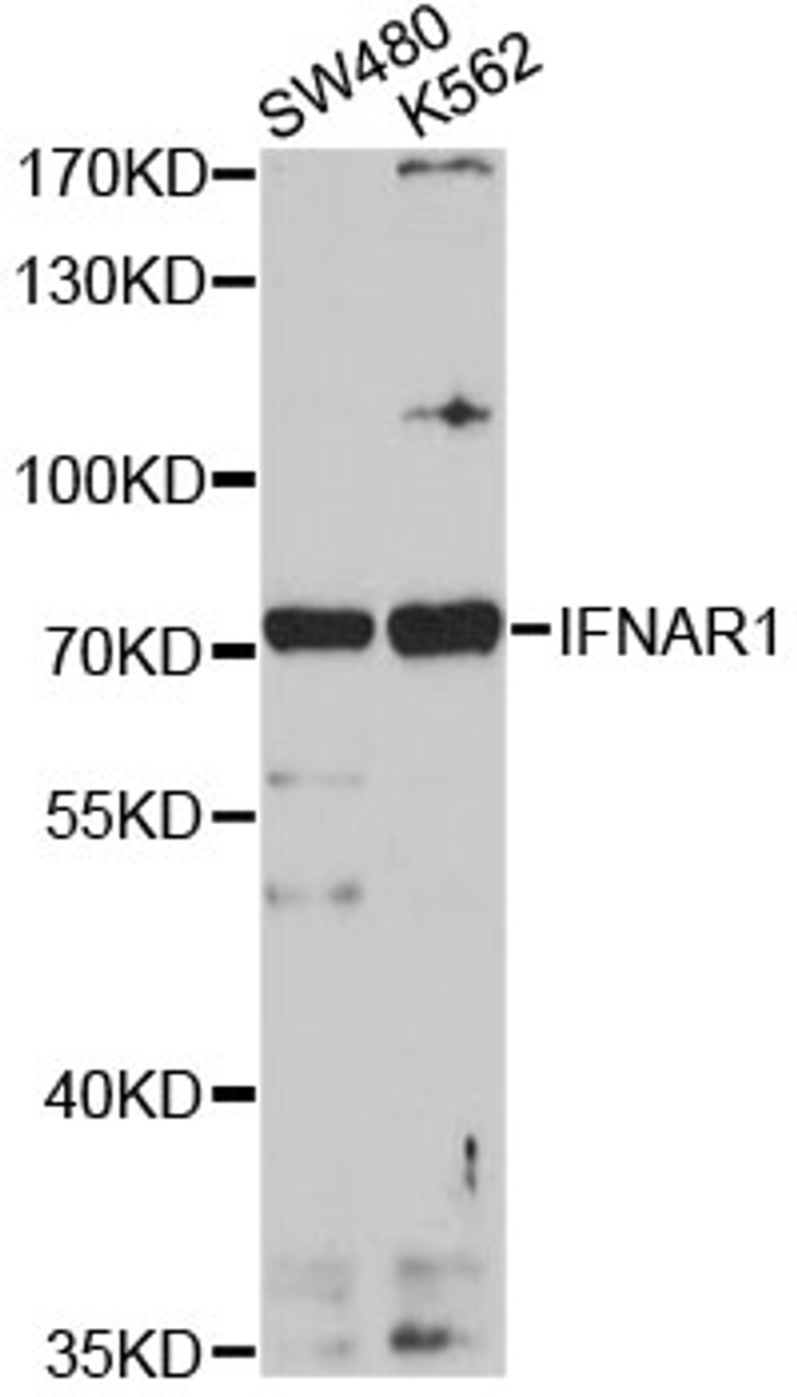 Western blot analysis of extracts of various cell lines, using IFNAR1 antibody (16-874) at 1:1000 dilution.<br/>Secondary antibody: HRP Goat Anti-Rabbit IgG (H+L) at 1:10000 dilution.<br/>Lysates/proteins: 25ug per lane.<br/>Blocking buffer: 3% nonfat dry milk in TBST.<br/>Detection: ECL Basic Kit.<br/>Exposure time: 90s.