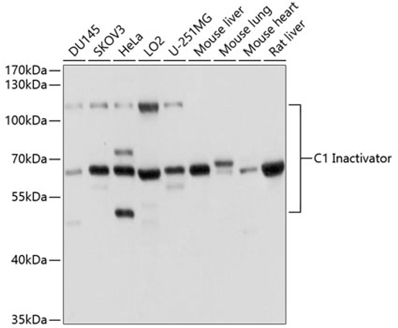 Western blot analysis of extracts of various cell lines, using C1 Inactivator antibody (16-878) at 1:1000 dilution.<br/>Secondary antibody: HRP Goat Anti-Rabbit IgG (H+L) at 1:10000 dilution.<br/>Lysates/proteins: 25ug per lane.<br/>Blocking buffer: 3% nonfat dry milk in TBST.<br/>Detection: ECL Basic Kit.<br/>Exposure time: 3s.