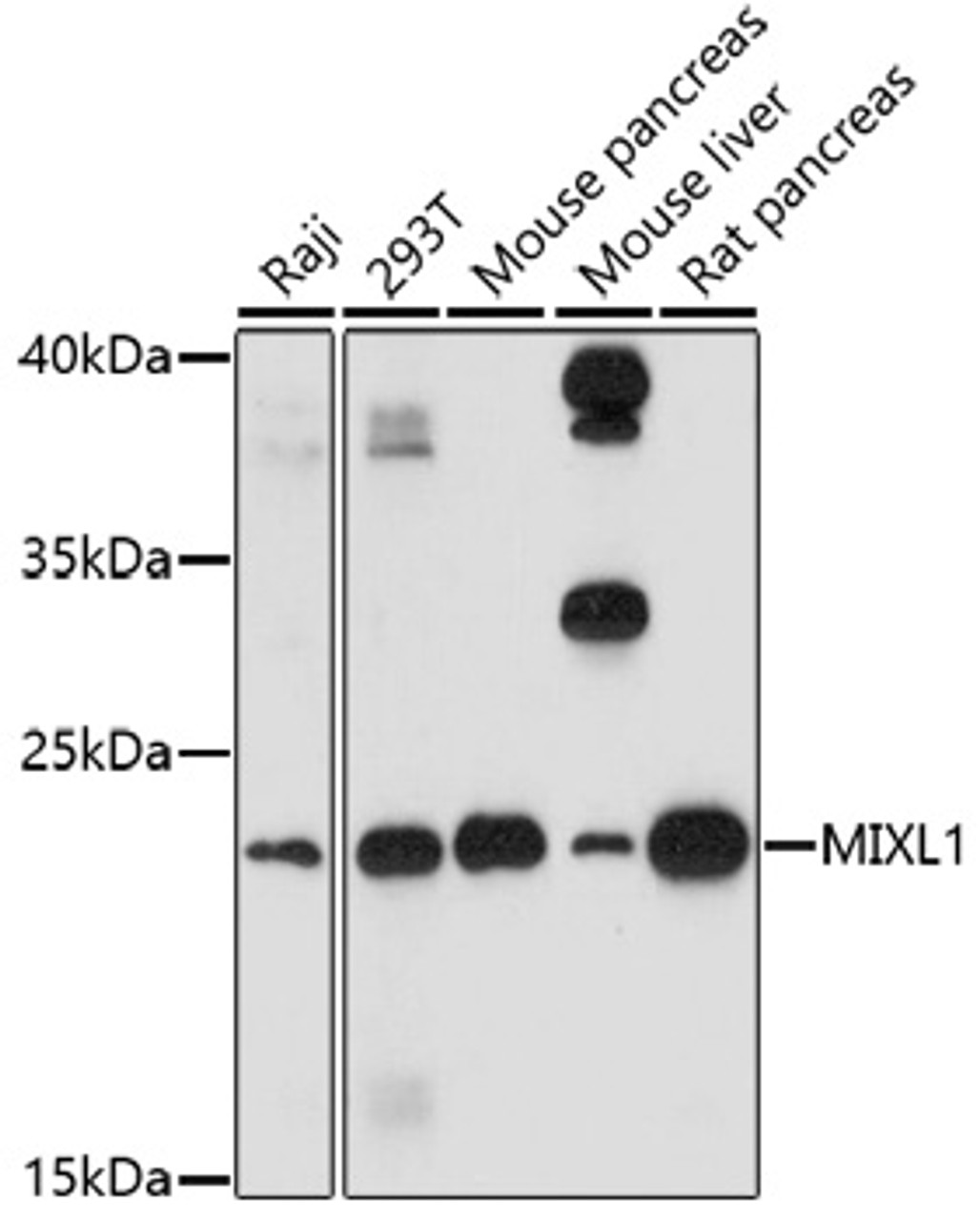 Western blot analysis of extracts of various cell lines, using MIXL1 antibody (16-887) at 1:1000 dilution.<br/>Secondary antibody: HRP Goat Anti-Rabbit IgG (H+L) at 1:10000 dilution.<br/>Lysates/proteins: 25ug per lane.<br/>Blocking buffer: 3% nonfat dry milk in TBST.<br/>Detection: ECL Basic Kit.<br/>Exposure time: 5min.