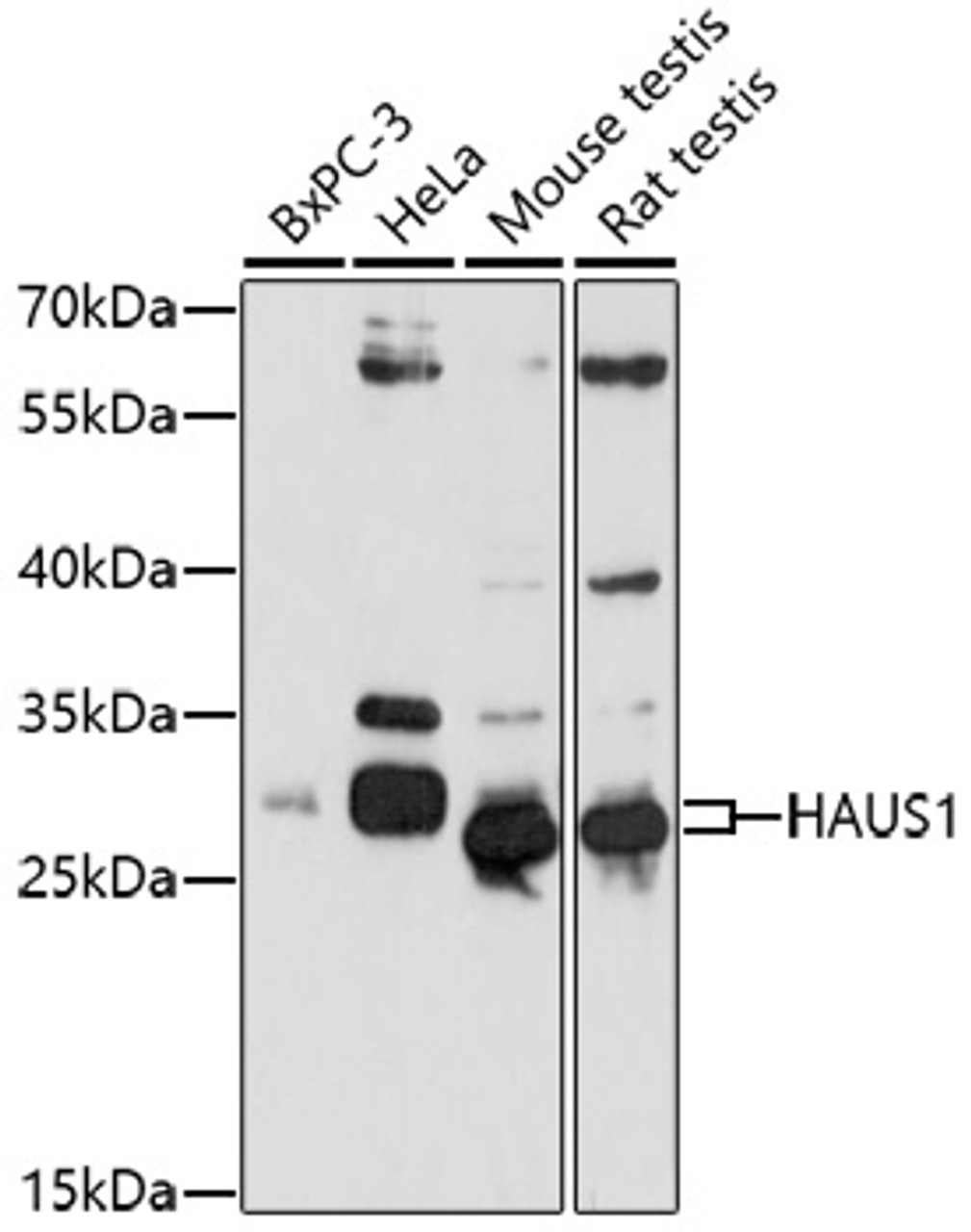 Western blot analysis of extracts of various cell lines, using HAUS1 antibody (16-894) at 1:1000 dilution.<br/>Secondary antibody: HRP Goat Anti-Rabbit IgG (H+L) at 1:10000 dilution.<br/>Lysates/proteins: 25ug per lane.<br/>Blocking buffer: 3% nonfat dry milk in TBST.<br/>Detection: ECL Basic Kit.<br/>Exposure time: 90s.