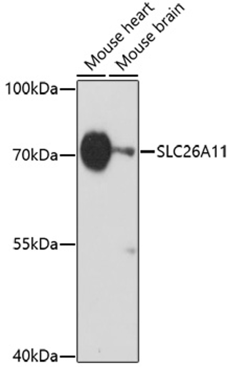 Western blot analysis of extracts of various cell lines, using SLC26A11 antibody (16-902) at 1:1000 dilution.<br/>Secondary antibody: HRP Goat Anti-Rabbit IgG (H+L) at 1:10000 dilution.<br/>Lysates/proteins: 25ug per lane.<br/>Blocking buffer: 3% nonfat dry milk in TBST.<br/>Detection: ECL Basic Kit.<br/>Exposure time: 60s.