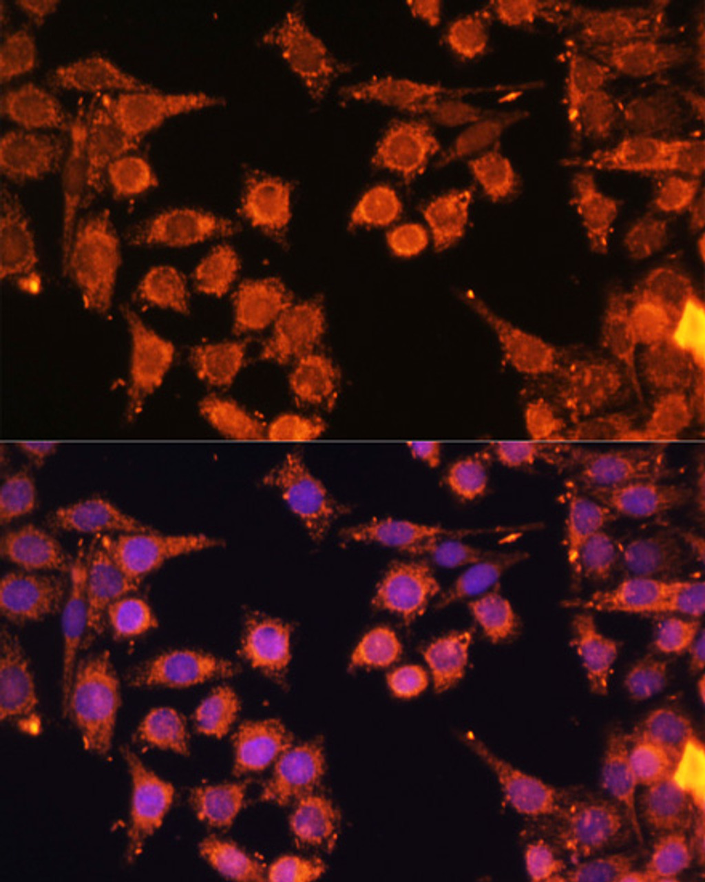 Immunofluorescence analysis of HeLa cells using PRKAA1/PRKAA2 antibody (16-906) at dilution of 1:100. Blue: DAPI for nuclear staining.